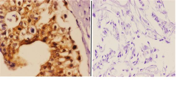 a00439 1 daxx primary antiboties ihc testing 2