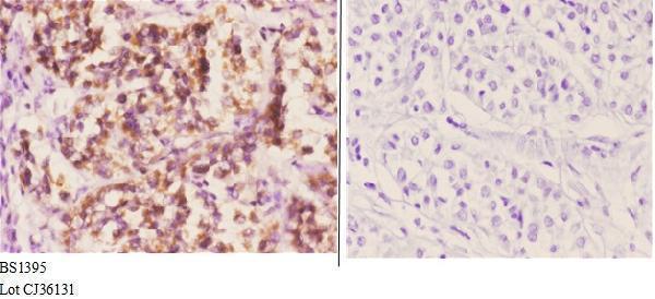 a00439 1 daxx primary antiboties ihc testing 3