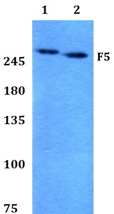 Western blot (WB) analysis of F5 polyclonal antibody at 1:500 dilution
Lane1:HEK293T whole cell lysate
Lane2:PC12 whole cell lysate 