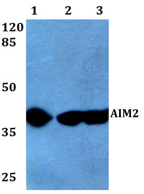 Western blot (WB) analysis of AIM2 (A78) pAb at 1:500 dilution
Lane1:K562 whole cell lysate(40ug)
Lane2:HCT116 whole cell lysate(40ug)
Lane3:SGC7901 whole cell lysate(40ug)