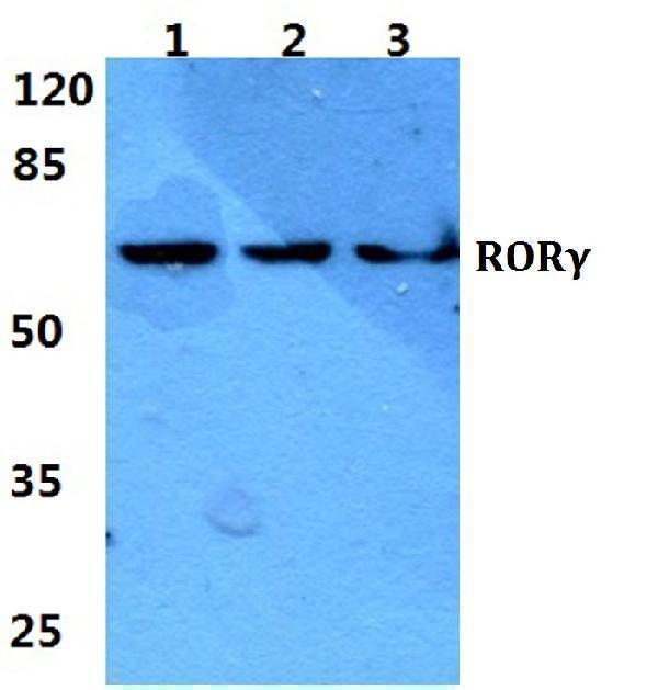 Western blot (WB) analysis of RORγ polyclonal antibody at 1:500 dilution
Lane1:Hela cell lysate
Lane2:sp2/0 cell lysate
Lane3:PC12 cell lysate