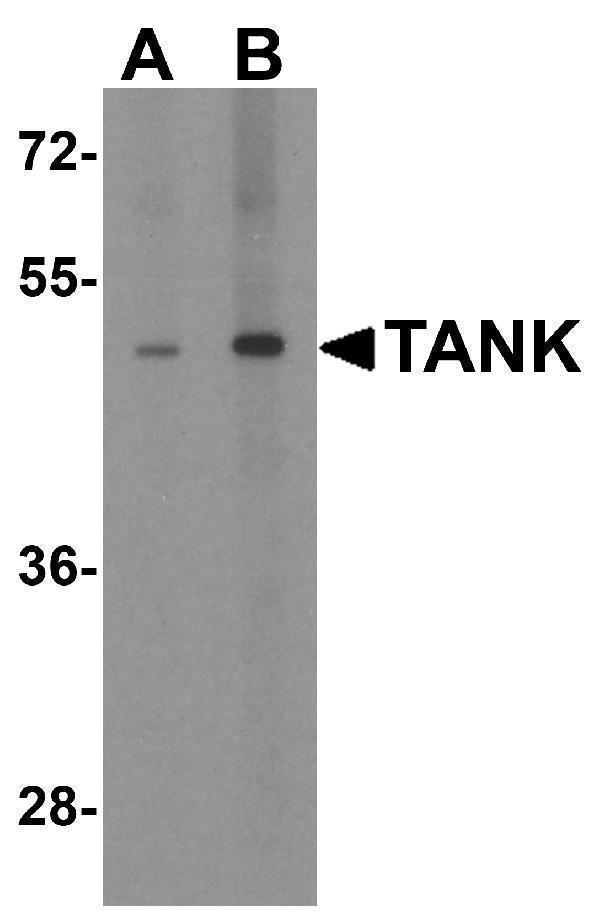 Western blot analysis of TANK in human kidney tissue lysate with TANK antibody at (A) 1 and (B) 2 μg/mL