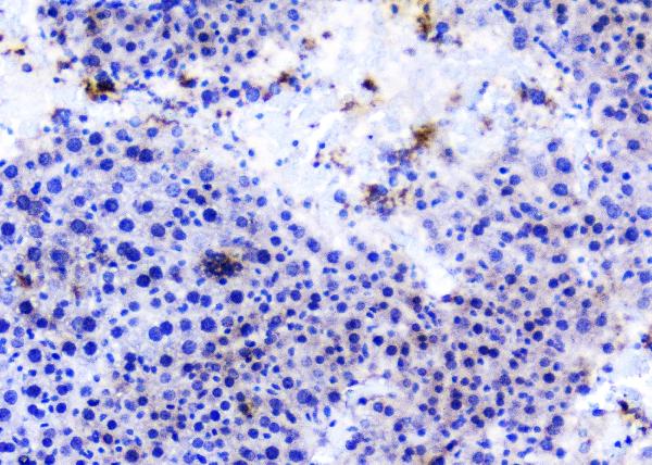 IHC analysis of TANK using anti-TANK antibody (A00445-3). TANK was detected in paraffin-embedded section of mouse liver tissues. Heat mediated antigen retrieval was performed in citrate buffer (pH6, epitope retrieval solution) for 20 mins. The tissue section was blocked with 10% goat serum. The tissue section was then incubated with 1μg/ml rabbit anti-TANK Antibody (A00445-3) overnight at 4°C. Biotinylated goat anti-rabbit IgG was used as secondary antibody and incubated for 30 minutes at 37°C. The tissue section was developed using Strepavidin-Biotin-Complex (SABC)(Catalog # SA1022) with DAB as the chromogen.