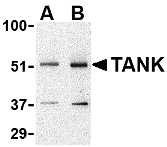 Western blot analysis of TANK in Daudi cell lysate with TANK antibody at (A) 0