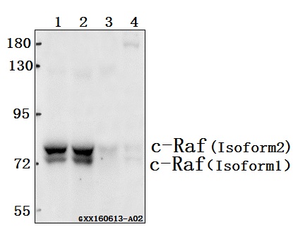 Western blot (WB) analysis of c-Raf /Raf-1 (Q253) polyclonal antibody at 1:500 dilution
Lane1:A549 whole cell lysate(40ug)
Lane2:SGC-7901 whole cell lysate(40ug)
Lane3:HCC827 whole cell lysate(40ug)
Lane4:The Muscle tissue lysate of Mouse(40ug)
