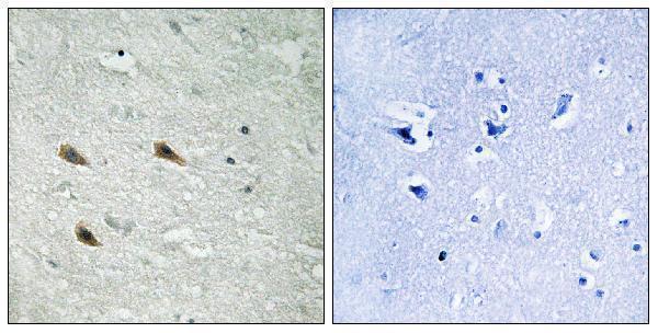 Immunohistochemistry analysis of paraffin-embedded human brain, using C-RAF (Phospho-Ser289) Antibody