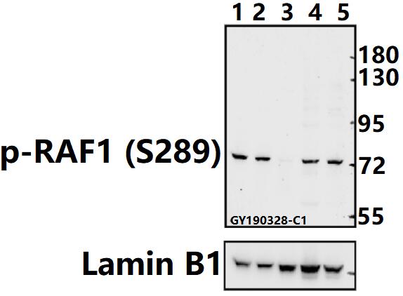 Western blot (WB) analysis of RAF1 (phospho-S289) polyclonal antibody at 1:500 dilution
Lane1:AML-12 whole cell lysate(40ug)
Lane2:CT26 whole cell lysate(40ug)
Lane3:PC12 whole cell lysate(40ug)
Lane4:HEK293T whole cell lysate(40ug)
Lane5:A549 whole cell lysate(40ug)
