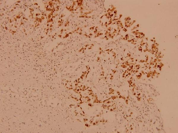 a00446s291 raf1 primary antiboties ihc testing 2