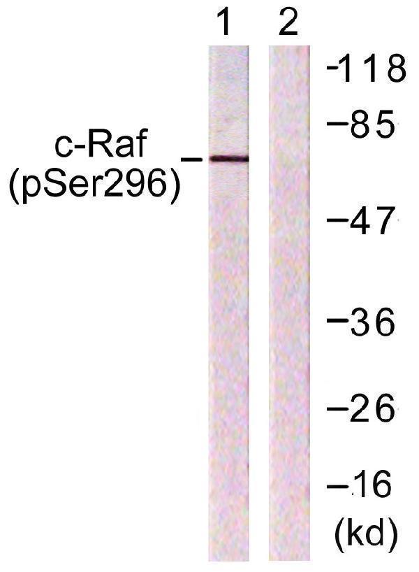 Western blot analysis of lysates from 293 cells treated with PMA 125ng/ml 30