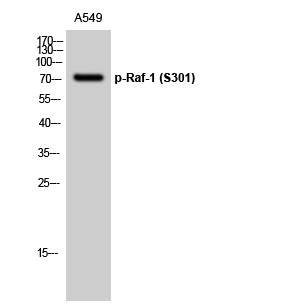 Western Blot analysis of A549 cells using Phospho-Raf-1 (S301) Polyclonal Antibody diluted at 1:1000