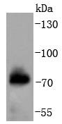Western blot analysis of Phospho-Raf1(S621) on human skeletal muscle lysates using anti-Phospho-Raf1(S621) antibody at 1/1,000 dilution