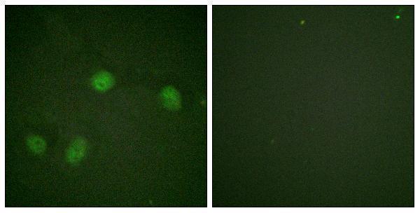 Immunofluorescence analysis of HeLa cells, using C-RAF (Phospho-Ser621) Antibody