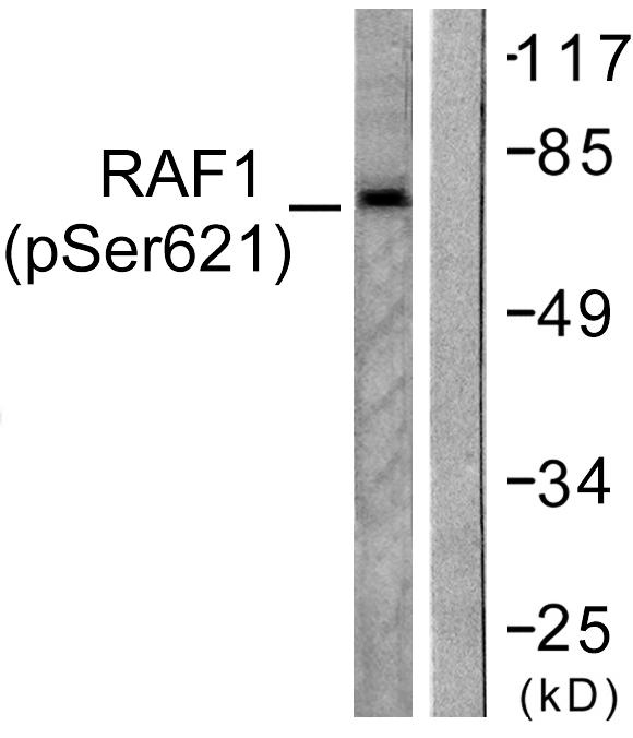 Western blot analysis of lysates from HeLa cells treated with UV 5', using C-RAF (Phospho-Ser621) Antibody
