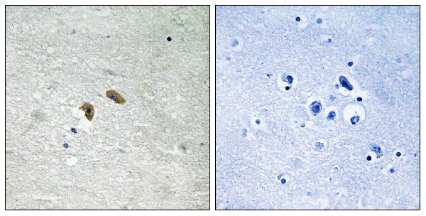 Immunohistochemistry analysis of paraffin-embedded human brain, using C-RAF (Phospho-Thr269) Antibody