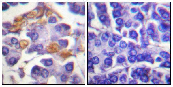 Immunohistochemistry analysis of paraffin-embedded human pancreas, using C-RAF (Phospho-Tyr341) Antibody