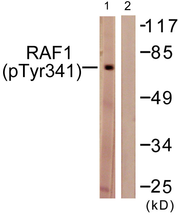 Western blot analysis of lysates from Jurkat cells treated with Paclitaxel 1uM 24h, using C-RAF (Phospho-Tyr341) Antibody