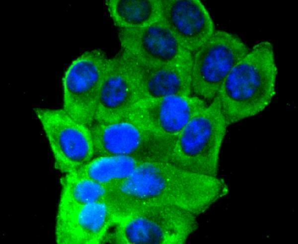 ICC staining Insulin Receptor in HepG2 cells (green)