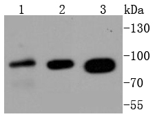 Western blot analysis of Insulin Receptor on different lysates using anti-Insulin Receptor antibody at 1/1,000 dilution