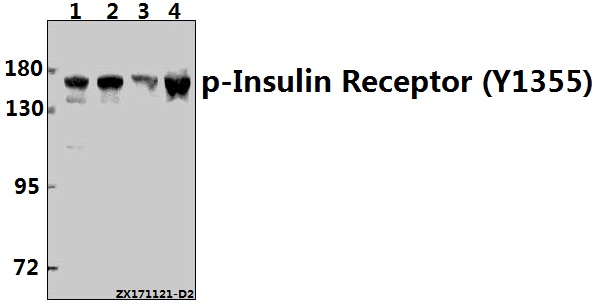 Western blot (WB) analysis of p-Insulin Receptor (Y1355) pAb at 1:500 dilution
Lane1:H1792 whole cell lysate(40ug)
Lane2:HepG2 whole cell lysate(40ug)
Lane3:A549 whole cell lysate(40ug)
Lane4:L02 whole cell lysate(40ug)