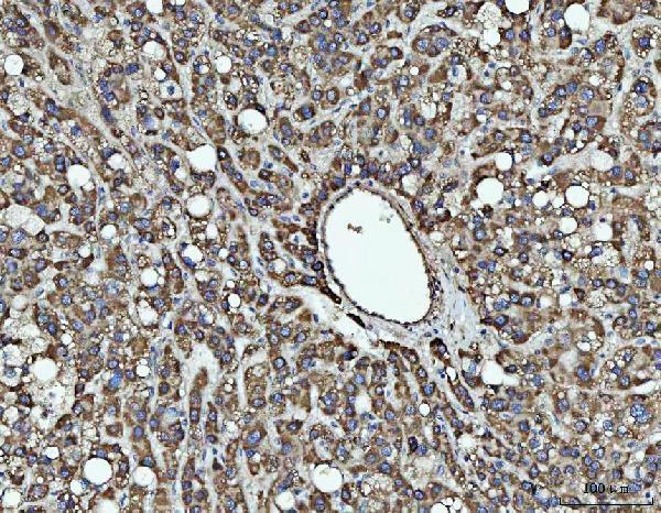  IHC analysis of SOCS1 using anti-SOCS1 antibody (A00448)