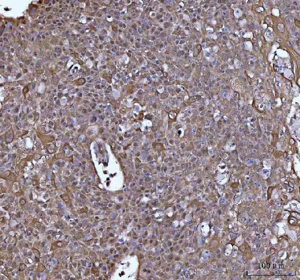 a00448 socs1 primary antibodies ihc testing 4