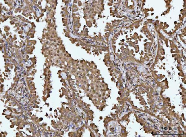 a00448 socs1 primary antibodies ihc testing 5
