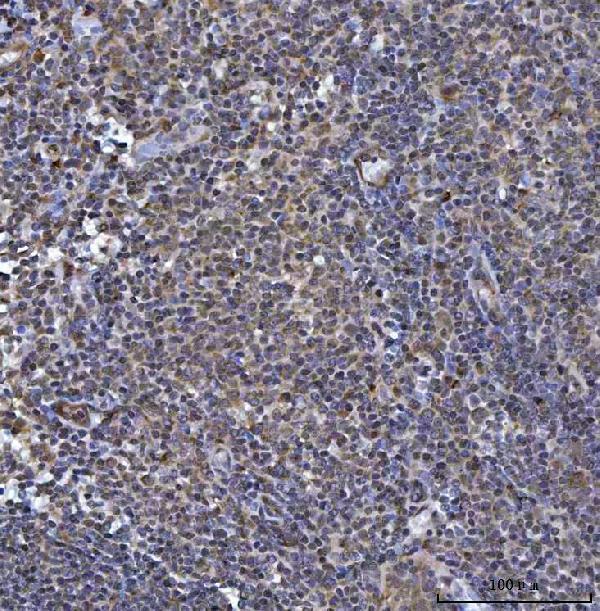 a00448 socs1 primary antibodies ihc testing 6