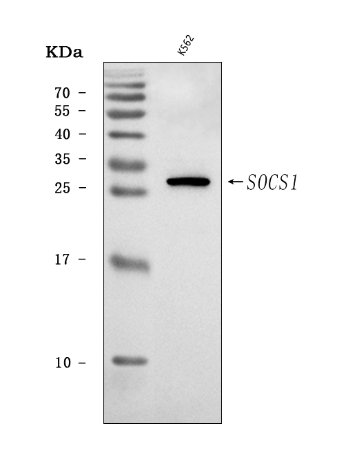  Western blot analysis of SOCS1 using anti-SOCS1 antibody (A00448)