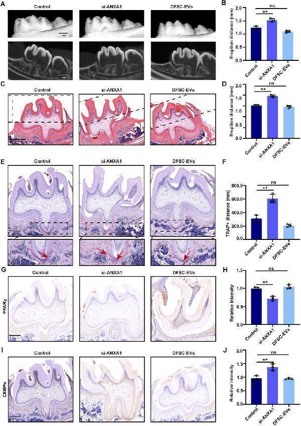 DFSCs-EVs/ANXA1 regulating tooth eruption by affecting osteoclast differentiation