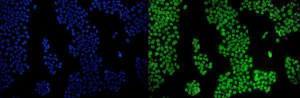 a00449 3 pparg primary antibodies if testing 2