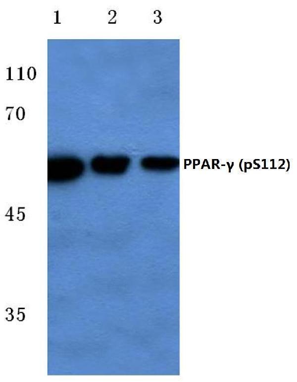 Western blot (WB) analysis of p-PPAR-γ (S112) polyclonal antibody at 1:500 dilution
Lane1:Hela cell lysate treated with colchicine
Lane2:Raw264