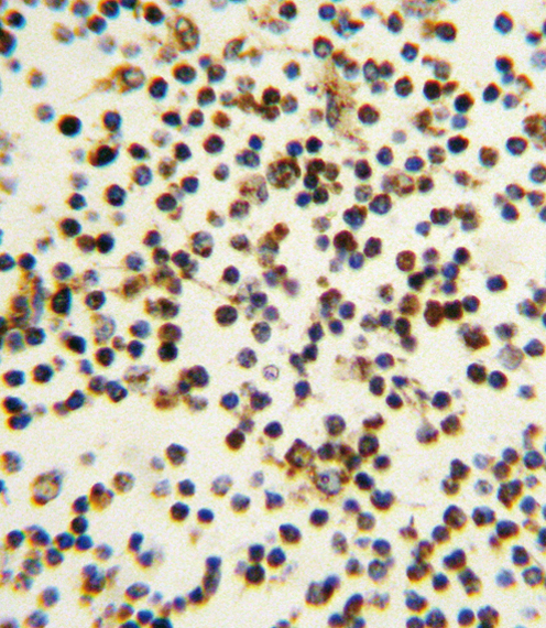 a00450 anti npm1 antibody n term ihc p testing 3