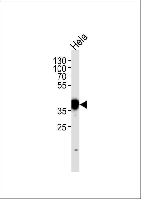 a00450 anti npm1 antibody n term wb testing 2