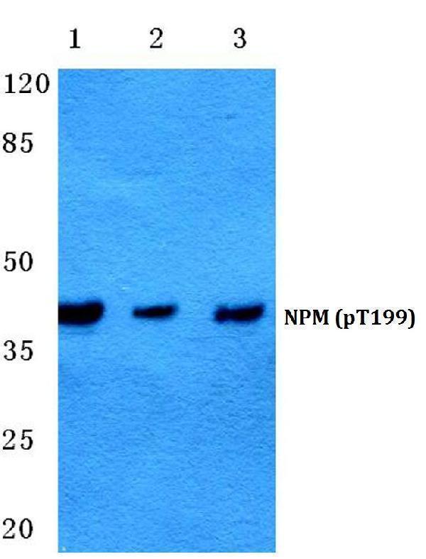 Western blot (WB) analysis of p-NPM (T199) polyclonal antibody at 1:500 dilution
Lane1:Hela cell lysate
Lane2:Mouse liver tissue lysate
Lane3:Rat liver tissue lysate