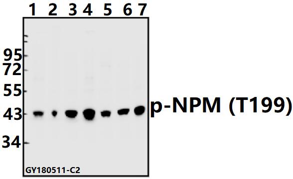 a00450t199 npm1 primary antiboties wb testing 1