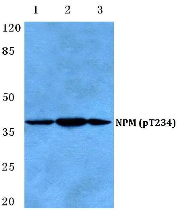 Western blot (WB) analysis of p-NPM1 (T234) polyclonal antibody at 1:500 dilution
Lane1:MCF-7 cell lysate treated with colchicine(0