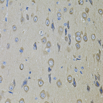 a00451 smo primary antiboties wb testing 2