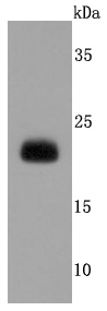 Western blot analysis of Lipocalin-2 on A431 cells lysates using anti-Lipocalin-2 antibody at 1/500 dilution