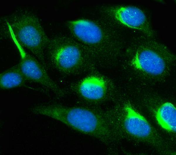 a00454 2 pak1 primary antibodies if testing 11