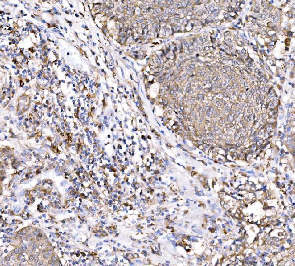  IHC analysis of PAK1 using anti-PAK1 antibody (A00454-2)
