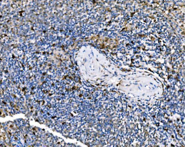 a00454 2 pak1 primary antibodies ihc testing 4
