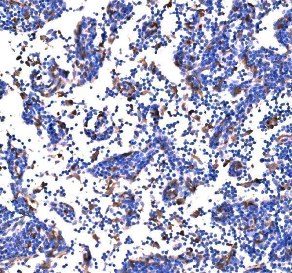 a00454 2 pak1 primary antibodies ihc testing 5