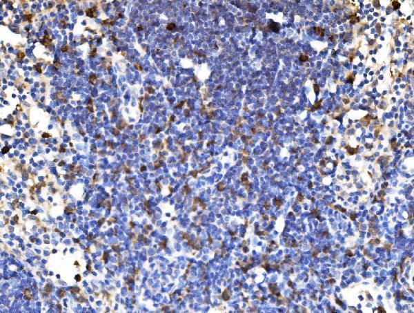 a00454 2 pak1 primary antibodies ihc testing 6