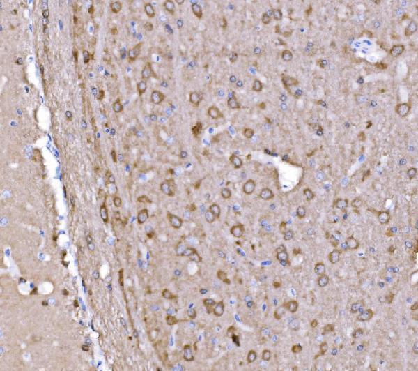 a00454 2 pak1 primary antibodies ihc testing 7