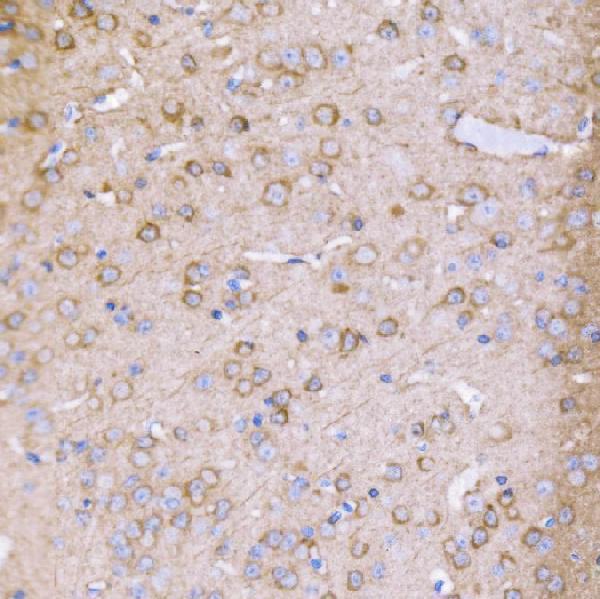 a00454 2 pak1 primary antibodies ihc testing 8