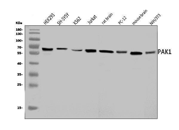  Western blot analysis of PAK1 using anti-PAK1 antibody (A00454-2)