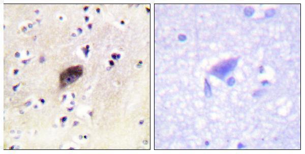 a00454s144 pak1 primary antibodies ihc testing 3