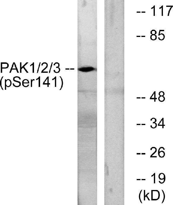 a00454s144 pak1 primary antibodies wb testing 2