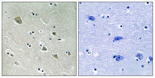 Immunohistochemistry analysis of paraffin-embedded human brain, using PAK1 (Phospho-Ser204) Antibody