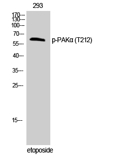 Western Blot analysis of 293 cells using Phospho-PAKα (T212) Polyclonal Antibody
